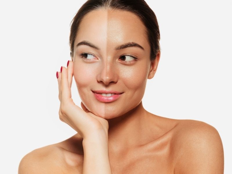 A woman's face is in the photo frame, and half of her face is a darker tan color than the other.